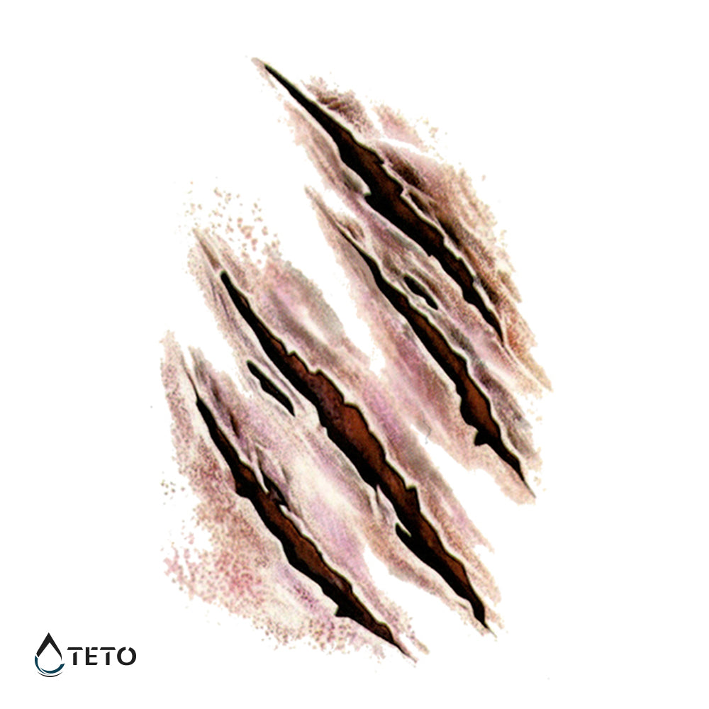 Brazgotine – praske - TETO Začasne Tetovaže