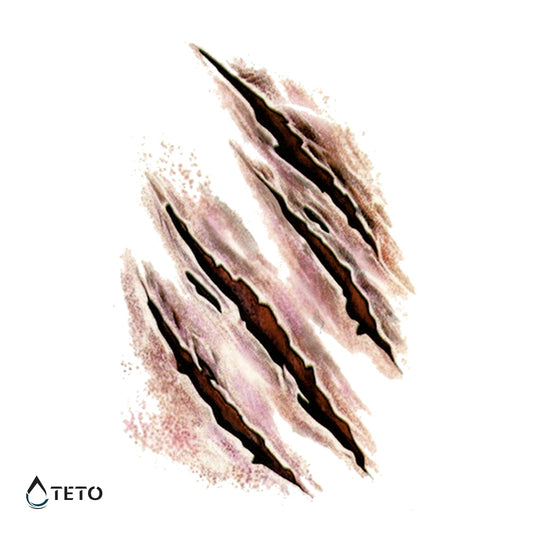 Brazgotine – praske - TETO Začasne Tetovaže