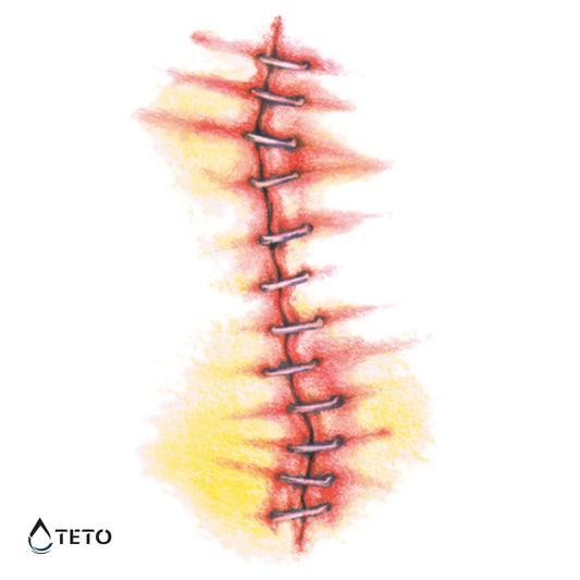 Šivi v koži - TETO Začasne Tetovaže